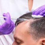 PRP Treatment in Gurgaon – Natural Healing for Hair & Skin