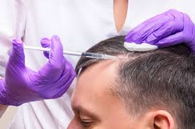 You are currently viewing PRP Treatment in Gurgaon – Natural Healing for Hair & Skin